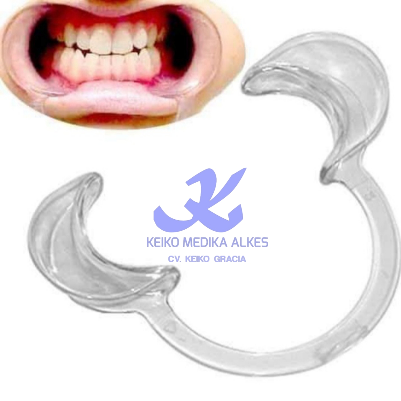 cheek retractor dental mulut / penahan mulut keiko medika alkes jambi